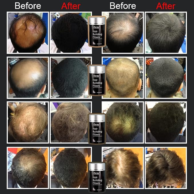 Hair Fibers for Thinning Hair (Medium Brown) - Hair Thickener for Fine Hair for Women & Men - Conceals Hair Loss in 15 Sec - 22gr Bottle