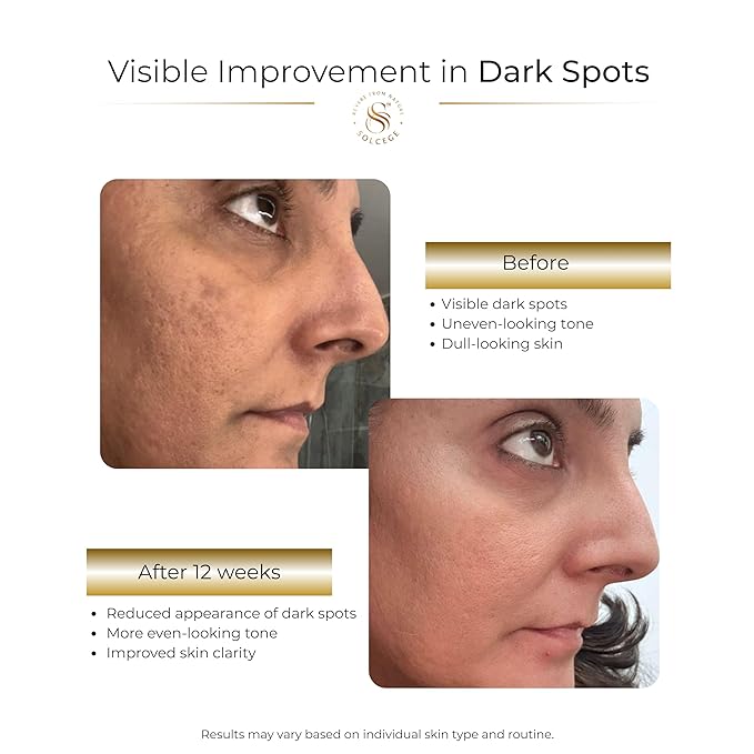 Dark Spot Corrector & Hyperpigmentation Treatment Cream for Face – Uneven Skin Tone Repair with Intense Hydration, Alpha Arbutin, Kojic Acid & Vitamin C – For Men & Women, 2 oz