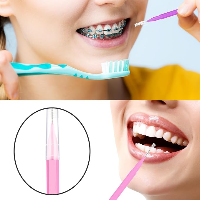Patelai 100 Pieces Braces Brush for Cleaner Interdental Brush Toothpick Dental Tooth Flossing Head Oral Dental Hygiene Flosser Toothpick Cleaners Tooth Tool(Pink,Purple,Suitable Size)