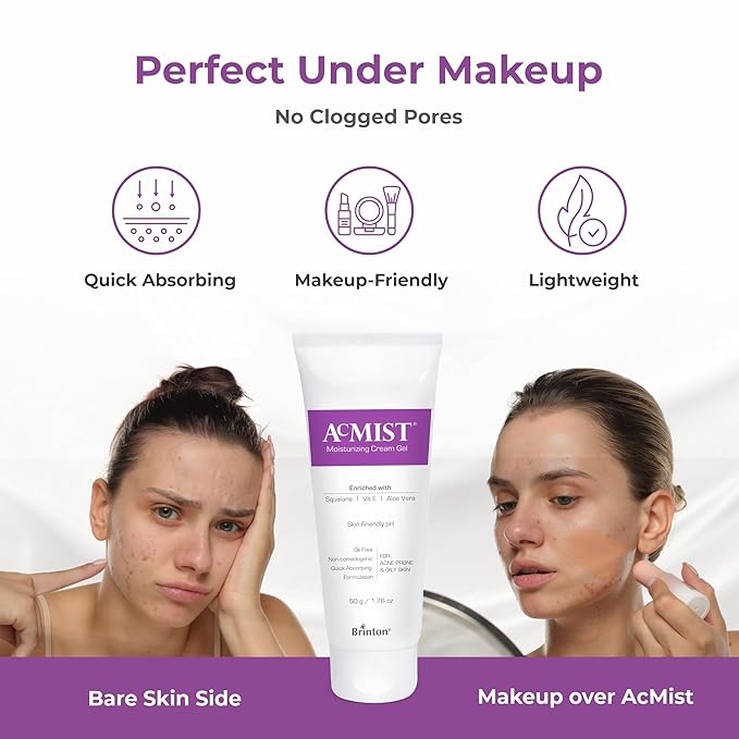 Acmist Moisturizing Cream Gel for Oily & Acne-Prone Skin | Oil-Free, Non-Comedogenic, Quick Absorbing & Makeup Friendly | With Vitamin E, Aloe Vera & Squalane | For Men, Women & Teens | 50g/1.67 oz.