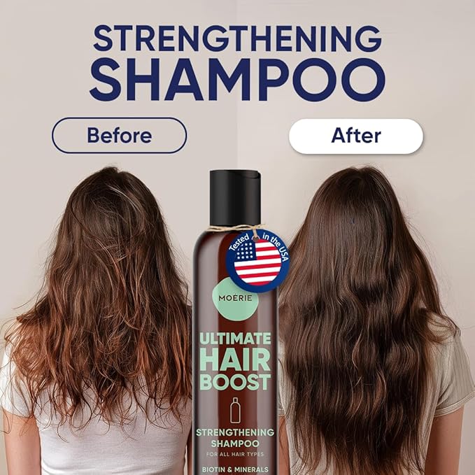 Moerie Hair Growth Shampoo for Men and Women, Hair Loss Solution with Biotin and Rosemary, Thickening Shampoo for Thinning Hair – Ultimate Boost for All Hair Types