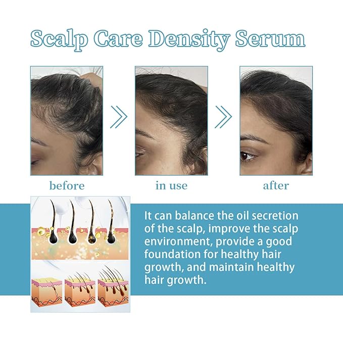 30ml Scalp Care Density Serum for Hair Growth – Reduces Hair Shedding, Thickens Thin Hair & Strengthens Roots with Natural Pea Extract, Collagen & Vitamin E