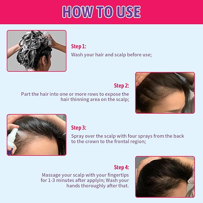 5% Minoxidil for Women Hair Growth with Biotin, Minoxidil Spray Helps Promote Thicker, Stronger & Fuller Hair, Supports Regrowth and Reduces Hair Thinning, Suitable for All Hair Types, 3.38 oz
