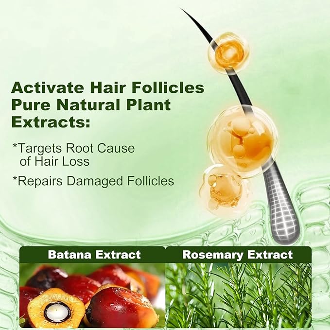 Tgideas Batana Oil & Rosemary Shampoo for Hair Growth, Formula for Thinning Hair & Reduce Hair Loss, Nourish Scalp & Add Volume, for Men & Women (Pack of 2)