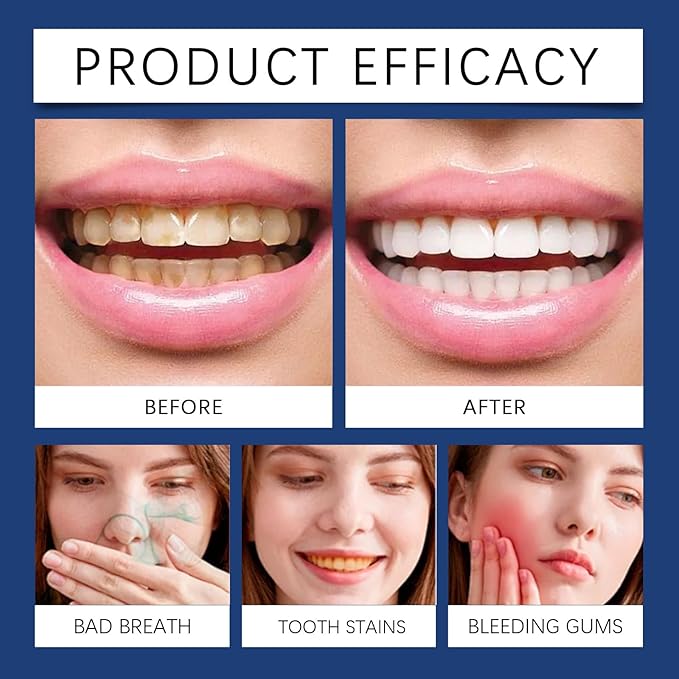 Gum Restore Drops, Natural Bad Breath Treatment for Adults, 2 Oz Gum Repair for Receding Gums, Advanced Formula for Gum Regrowth, Fresh Breath Instantly, Dry Mouth Relief for Adults