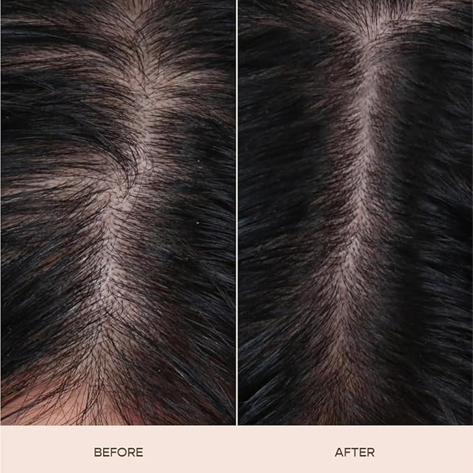 Raw veel Advanced Hair Serum | 2.5% Capilia Longa + 3% Anagain + 2% Redensyl + 2% Adenosine, Rosemary & Pumpkin Seed | Promotes Hair growth | Hair Serum for Men & Women | 30ml