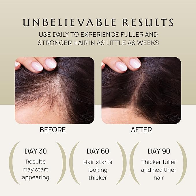 Hair Growth Oil Spray - 100% Pure Ingredients For Non Greasy, Thicker & Stronger Hair - Organic Batana, Castor, Biotin, Saw Palmetto, and Rosemary Oil Gifts Women Scalp (4.1 Fl Oz (Pack of 3))