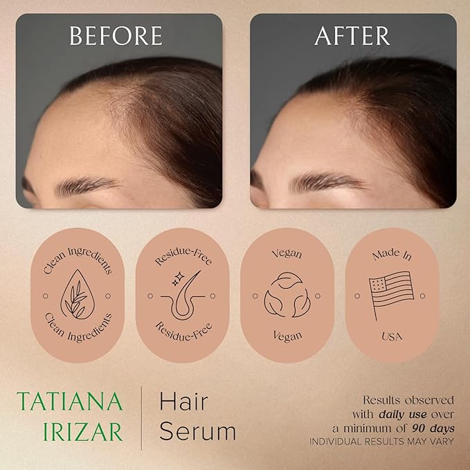 Caffeine Hair Growth Serum Women Made in USA - Peptide Hair Density Serum Non-Greasy Biotin Rosemary & Amla with Caffeine - Scalp 1 Fl.Oz Natural Residue-Free - Growing Scalp Women Regrowth Treatment