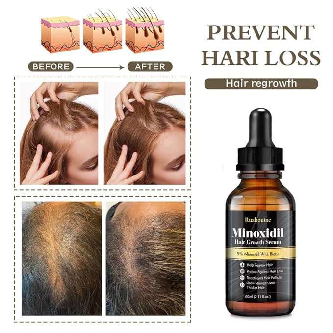 Hair Growth Treatment for Thicker Longer, 5% Minoxidil Biotin Hair Growth Serum Oil for Men and Women, Prevents Hair Loss and Thinning, 2.11 fl.oz