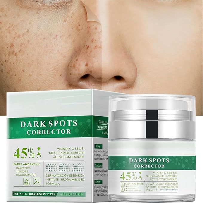 Crema para Manchas Oscuras en La Cara, Cremas para Quitar Manchas de La Cara, Crema para Las Manchas de La Cara, 50 ML / 1.7 FLOZ