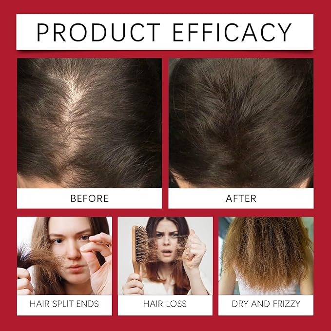 15ml Hair Growth Serum for Thinning Hair – Nourishes Scalp, Strengthens Roots, Reduces Hair Loss & Breakage with Rosemary, Pumpkin Seed & Saw Palmetto