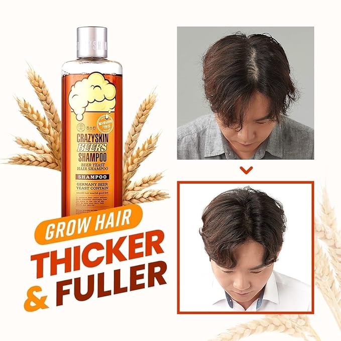 CRAZY SKIN German Beers Yeast Biotin Shampoo for Anti-hair loss, and Thickening,Gentle Exfoliating & Scalp Function with Panthenol, Collagen and Free-Sulfate, limescale removal, 300ml(10.15oz)