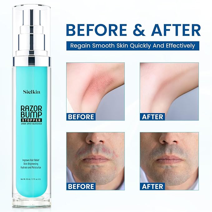 Shave Razor Bump Ingrown Hair Aftershave: Treatment Lotion for Sensitive Zone - Men & Women Skin Care Upgraded Formula 1.7 Fl Oz