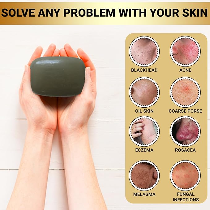 Dead Sea Mud Soap Bar Face and Body Cleanser | Deep Pore Cleansing Natural Bar Soap for Women and Men 3.17 oz