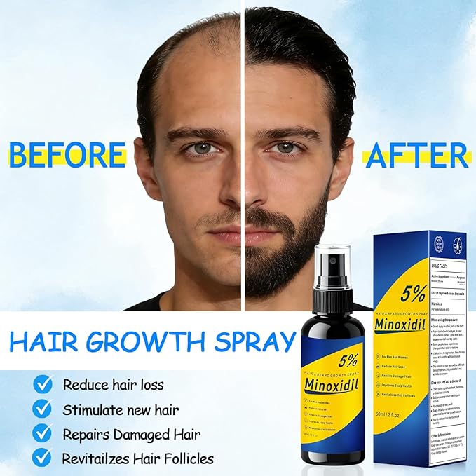 5% Minoxidil for Men, Minoxidil for Women Hair Growth, 2 Fl Oz (60ml) Minoxidil 5% Hair Regrowth Treatments, Minoxidil Spray for Thinning and Loss, Yellow and Blue