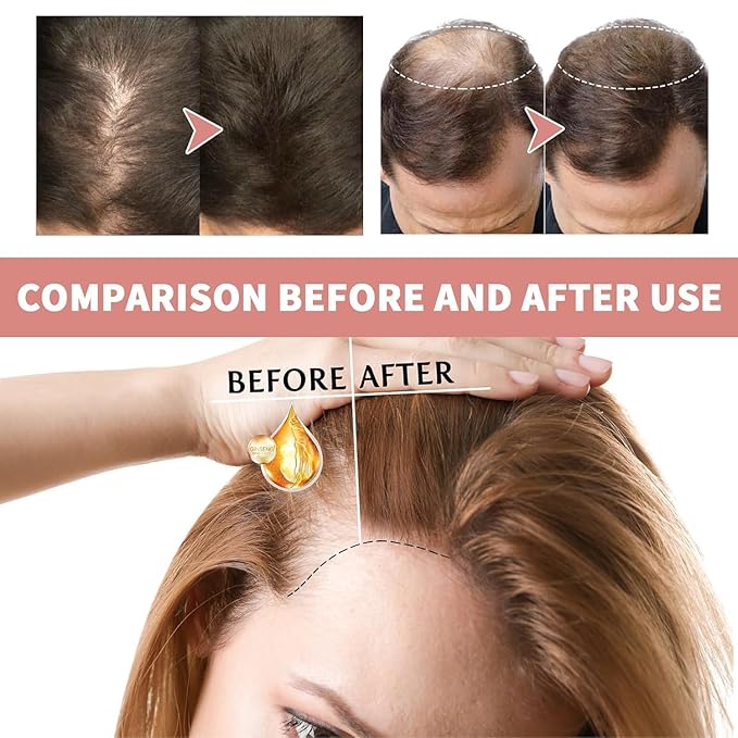 Hair Ampoule Treatment, Hair Lotion for Damage and Dry Hair, Hair Stimulant Intensive Lotion, Instant Hair Strength Ampoule (1 Set)