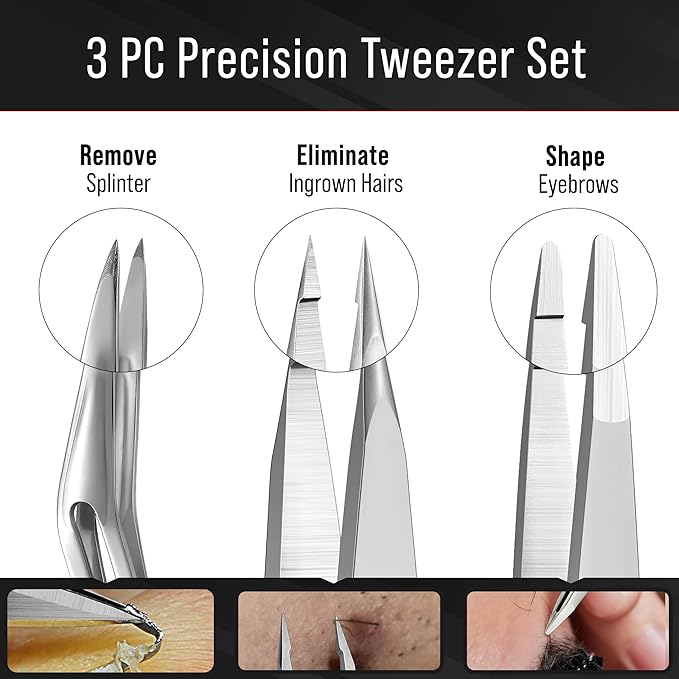 DUROX 3-Piece Tweezer Set — 1.Pointed Ingrown Hair Tweezers, 2.Fine-Tip Splinter Tweezers, 3.Safety Round Tip for Facial & Chin Hair Removal. Made of stainless steel. Protective pouch for safe storage