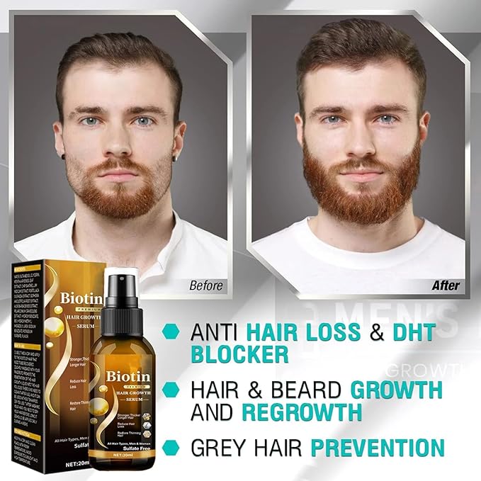 Biotin Hair Growth Serum，Hair Growth Spray Containing Ginseng Root Extract and Ginger Root Extract，Moisturizes the scalp, strengthens hair follicles, prevents hair loss, and promotes hair growth.