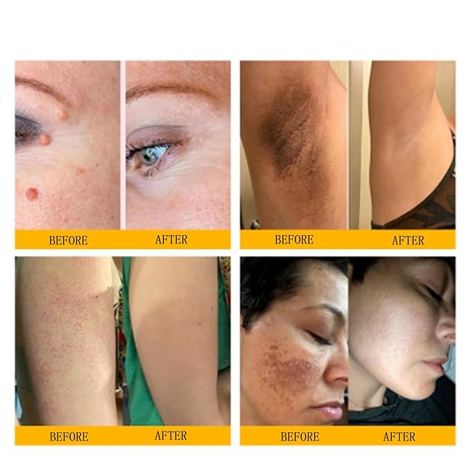 Bee Venom Comprehensive Cream, 2025 New Skincare Treatment Bee Venom Skin Cream, Visibly reduces skin blemishes, Natural Skin Moisturizer for Face and Body