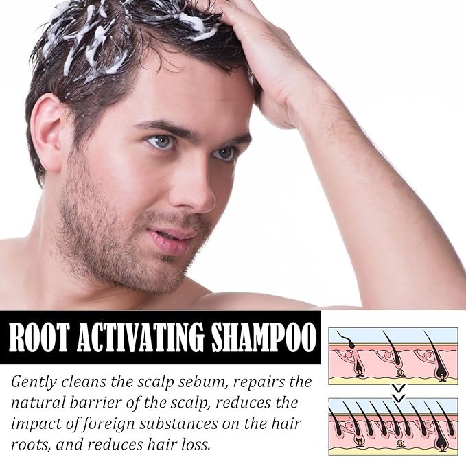 Root Activator Shampoo for Men: Hair Growth Shampoo for Hair Loss and Thinning Hair, For Anti-Hair Loss, Natural Regrowth Formula for Men and Women - 6.7 fl oz / 200 mL