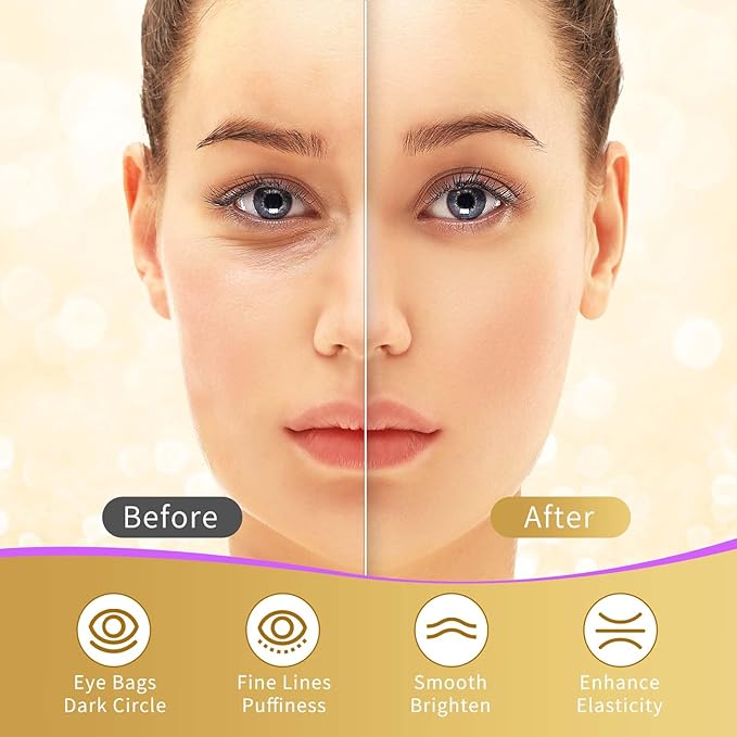 Under Eye Patches, 20 Pairs Eye Mask for Dark Circles,Puffy Eyes,Undereye Bags,Wrinkles,Eye Mask Patches with Hyaluronic Acid, 24K Gold,Rose & Aloe Vera,Eye Treatment Skin Care for Men & Women Gift