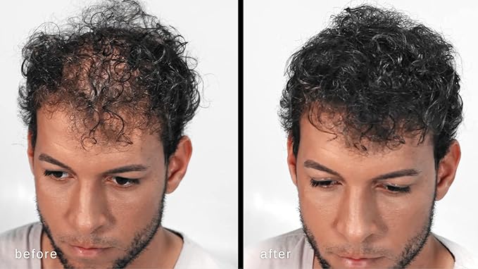 Hair Building Fibers - Volumizing Hair Fibers with real Keratin for Thinning Hair/Hair Loss Dermatologist Tested and Certified Hypoallergenic - 60 days + supply(Dark Brown)
