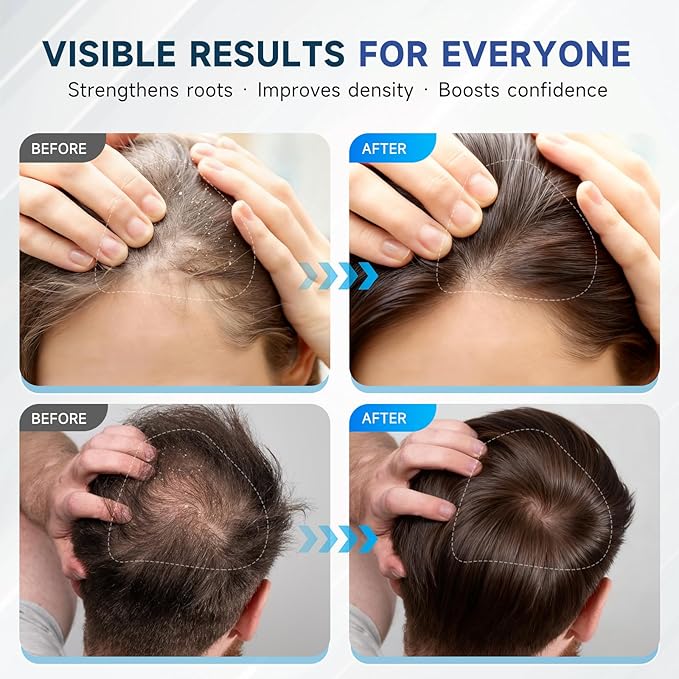 Hair Growth Shampoo with Biotin and Rosemary, Routine Shampoo for Hair Loss and Thinning, Natural Thickening Formula with Argan Oil, Tea Tree Oil and Caffeine, Sulfate Free with Comb, 11.84 FL