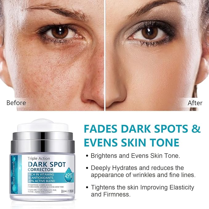 Dark Spot Remover for Face and Body, Dark Spot Corrector Cream, Dark Spot Corrector Cream for Age Spot, Blemish Spot, Melasma, Freckle, Sun Spots Remover & Blemish Reducer for Women Men