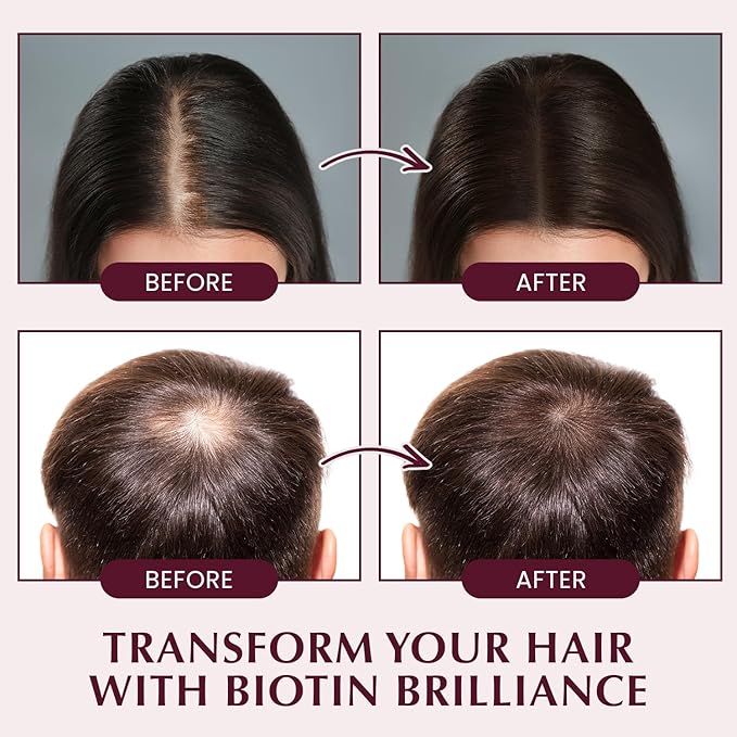 Hair Growth Shampoo for Thinning Hair: Advanced Biotin and Rosemary Shampoo with Rice Water for Women and Men Hair Loss - Herbal Essences Promotes Thicker Hair, 10.56 Fl Oz