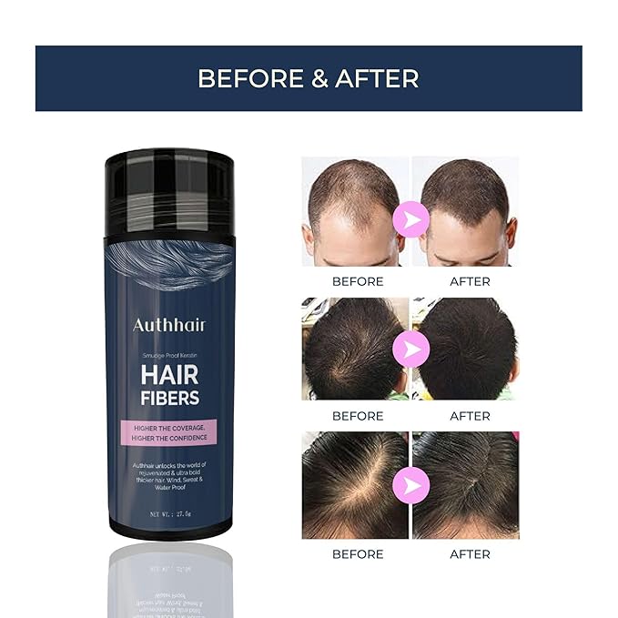 Hair Fibers for Thinning With Spray Applicator Pump Nozzle, Undetectable Natural Formula, Thicker Fuller Hair in 15 Seconds, Conceals Balding Areas for Men Women, 0.97Oz (Dark Brown)