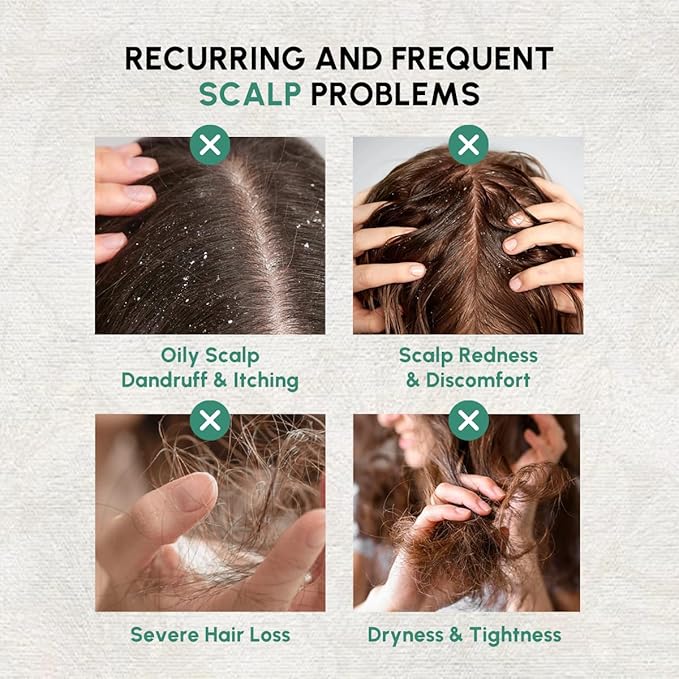 HomeLava Scalp Essence for Women & Men, Hair Care Serum - Botanical Scalp Nourishing Liquid for Dry & Oily Scalp, Scalp Care Lightweight and Gentle - 30ml