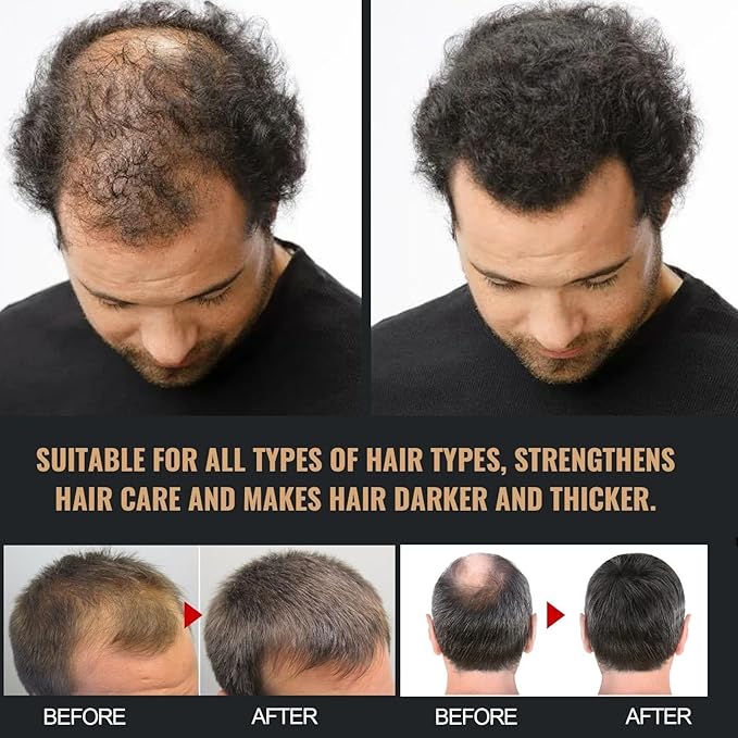 350ML Root Activator Shampoo,Hair Regrowth, Unisex, Natural Formula for Men and Women,Smooth Strong Repair Conditioning Shampoo (350 ML)