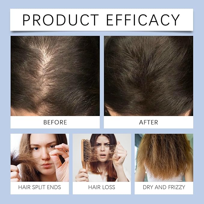 100ml Rosemary Hair Growth Oil - Scalp Care & Hair Repair Treatment with Jojoba & Castor Oils for Dry, Damaged Hair - Reduces Split Ends & Frizz