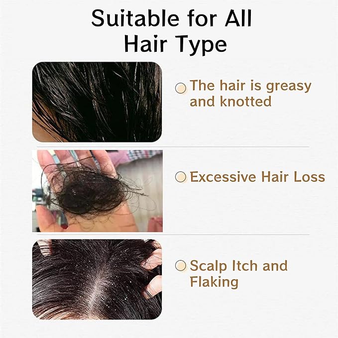 1 PCS Anti Hair Loss Shampoo, Promote Hair Growth and Thickening & Strengthening Shampoo with Various Plant Extracts for Thinning Hair Women（300ml）