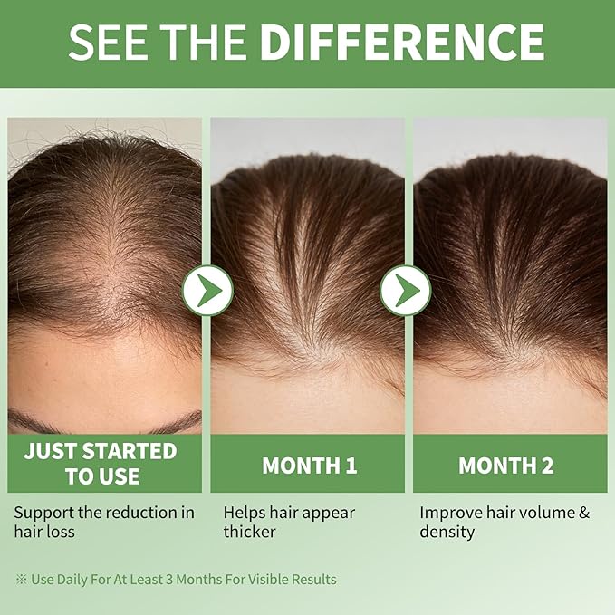 Rosemary Oil for Hair Growth Serum Roll On with 3% Rosemary, Hydrating & Non-Greasy Scalp Serum for Thicker-Looking Hair, Daily Care Massage Roller Applicator for Men & Women, 25ml
