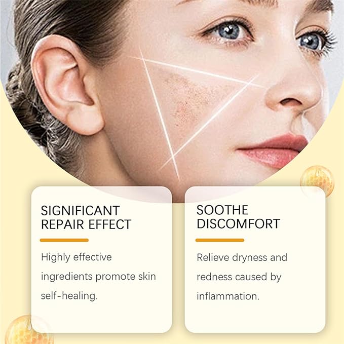 Bee Venom Comprehensive Cream, 2025 New Skincare Treatment Bee Venom Skin Cream, Visibly reduces skin blemishes, Natural Skin Moisturizer for Face and Body