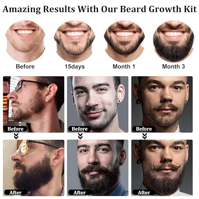 Beard Growth Kit, Upgraded Beard Growth Oil (2Oz) w/3 X Thickening Biotin & Castor Oil for Spot/Patchy Beard, Achieve Fuller, Thicker & Healthier Beards, Birthday Gifts for Men Him Boyfriend Husband