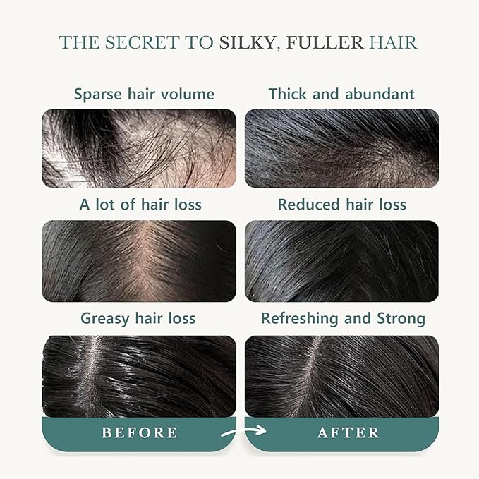 Rosemary Biotin Shampoo，Thickening Shampoo with Amino Acids for Hair Loss，Dandruff Control & Oily Scalp，Vegan, for Women & Men (Standard, Rosemary)