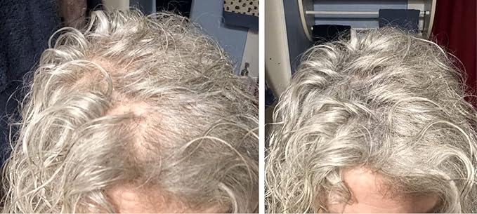 Caboki Hair Fibers for Thinning Hair – Natural Plant-Based Hair Powder for Men & Women – Instantly Thicker Fuller Looking Hair – Wind & Sweat Resistant – 30g, 90-Day Supply, Gray