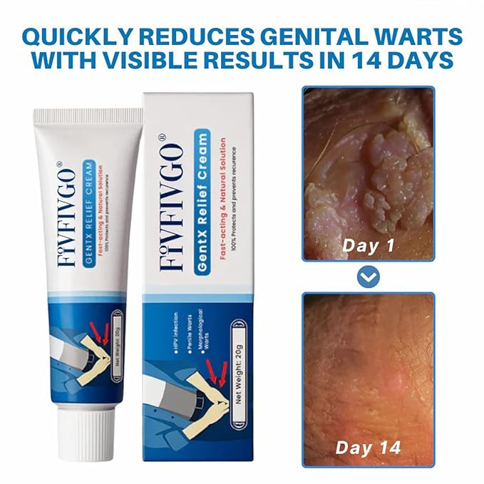 Fivfivgo Relief Cream,Men's GentX Relief Cream,Soothing and moisturizing, fast absorbing, refreshing and non-greasy formula, suitable for all skin types (1PC)