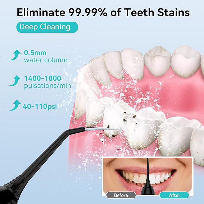 Water Flosser Cordless Oral Irrigator with 4 Modes and 4 Jet Tips, IPX7 Waterproof, 300ml/10oz for Adults, Home and Travel Use in Black