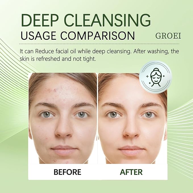 Tea Tree Facial Cleanser 150ml – Oil Control Face Wash with Vitamin – Refreshing Gel Cleanser for Combination & Oily Skin (1PC)