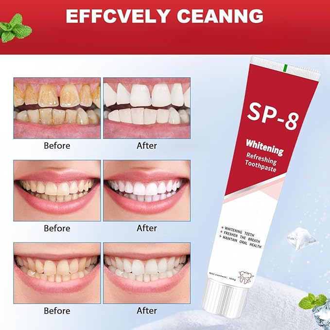 SP-8 Probiotic Toothpaste, SP8 Toothpaste Fresh Breath, Deep Cleaning Care (01)