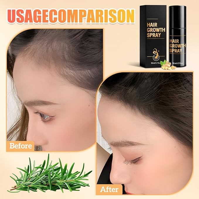 Hair Growth Spray,Hair Growth,Promotes Thicker, Fuller Hair For Women & Men – All Hair Types With Natural Ingredients(1PCS)