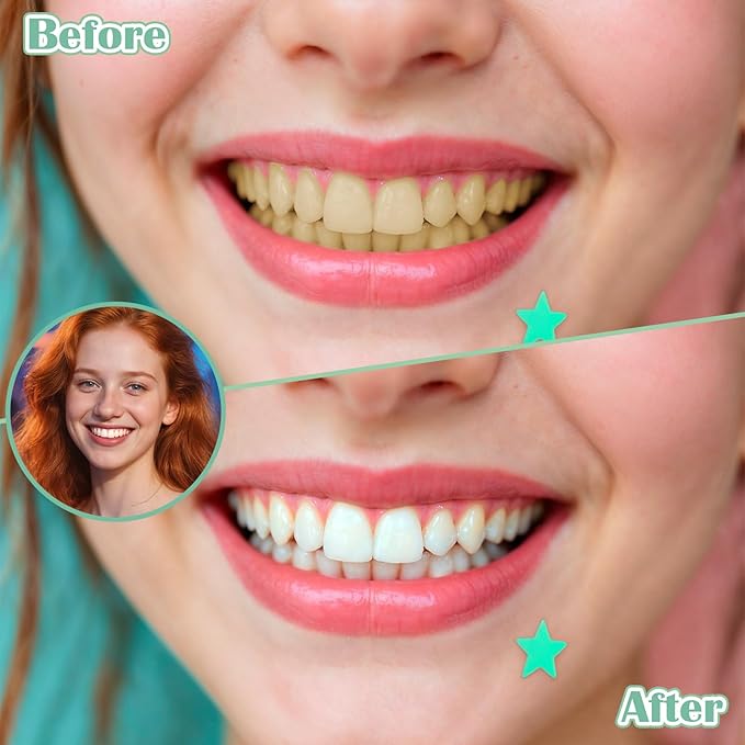 SynHHergyx 100 PCS Brushes for Braces Dental Brushes Picks Interdental Brush Teeth Brush Picks Dental Cleaning Tools for Braces Bridges Care, Portable Bendable Heads