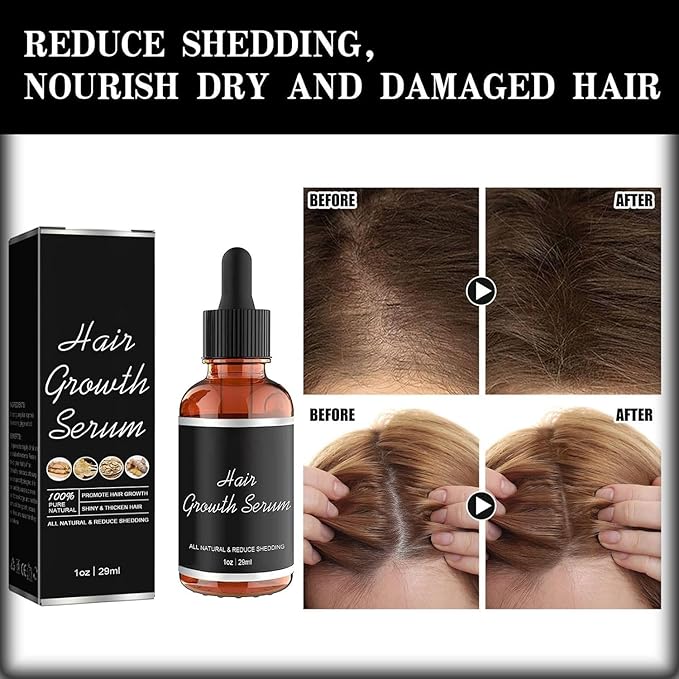Hair Growth Serum Designed for Black Women with Herbs and Natural Vitamin (2 Pcs)