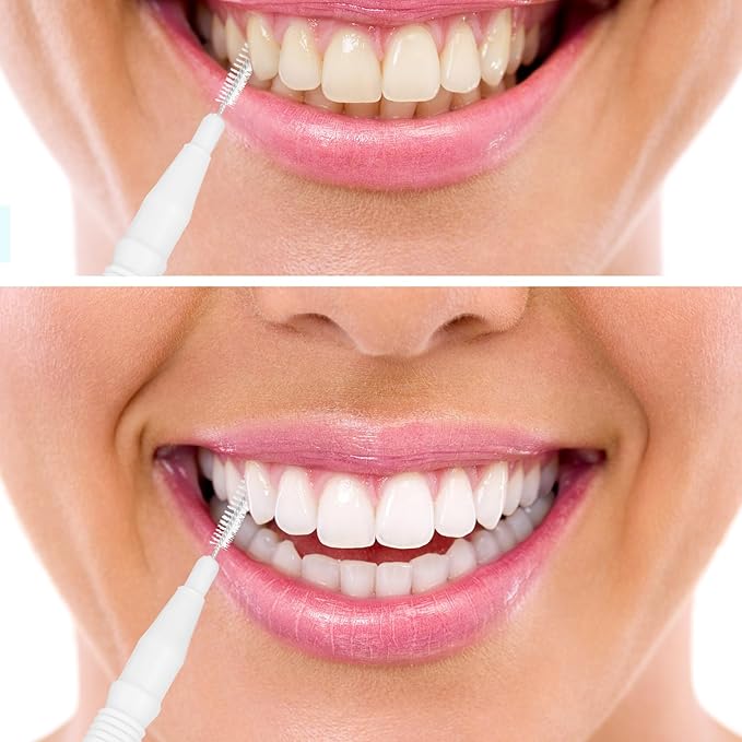 BBTO 100 Pcs Braces Dental Brush Flosser for Cleaner Interdental Brush Toothpick Tooth Flossing Head Oral Dental Toothpick Cleaners Cleaning Tool (Black, White)