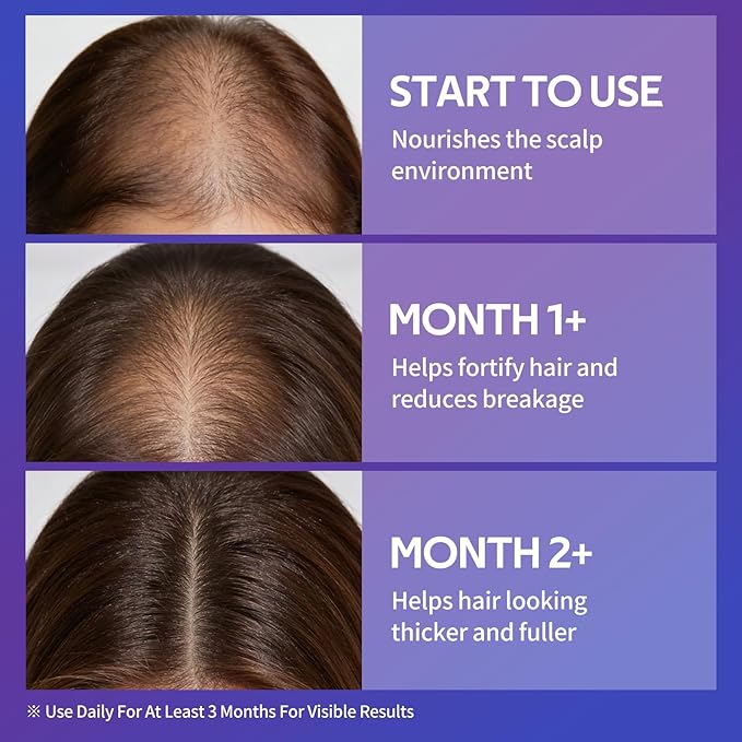 Hair Growth Serum Spray with Rosemary Oil, Biotin & Caffeine, Fast Absorbing Non-Greasy Scalp Serum for Fuller-Looking Hair, Alcohol-Free Nourishing Scalp Spray for Women & Men, 60ml