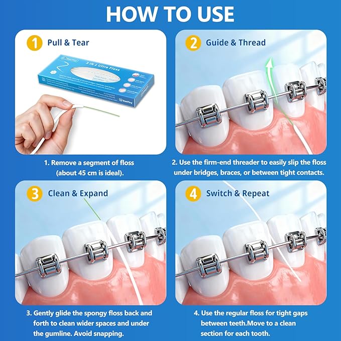 3-in-1 Orthodontic Floss for Braces, 160 Pre-Cut Strands with Threader & Spongy Brush, Specialized Teeth Cleaning for Teens and Adults with Bridges or Implants, 2 Pack