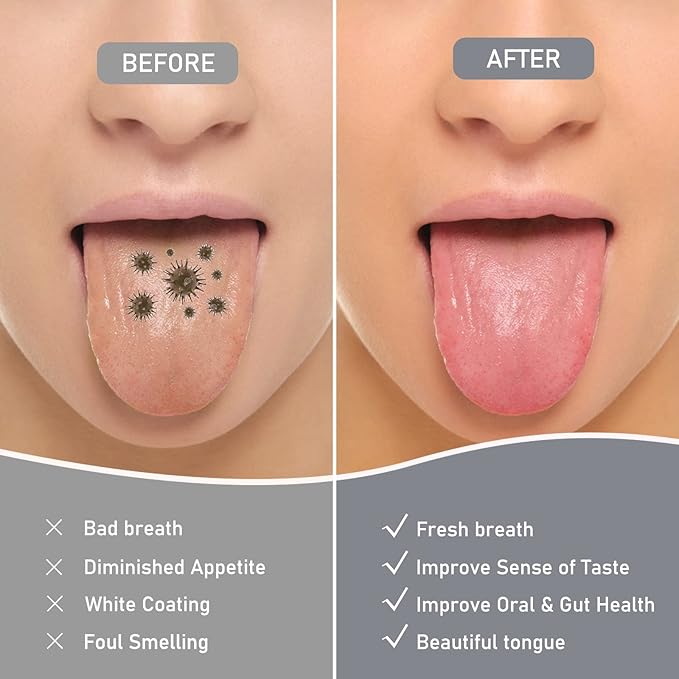 4 Pack Tongue Scraper, Hygienic Seal-Pack, Professional Eliminate Bad Breath, Stainless Steel Tongue Scrapers, Effectively Improve Oral And Gut Health -silver